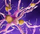 Les infections virales augmenteraient le risque de maladie d'Alzheimer