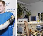 Les progrés de la bionique et de la neuronique changent la vie des handicapés