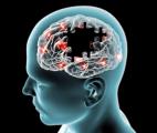 L’exposition à certains virus augmente considérablement les risques de maladies neurodégénératives