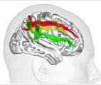 L'hémisphère droit : cerveau de l'attention visuospatiale