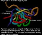 Maladie de Huntington : restaurer la transmission neuronale à la naissance pourrait prévenir l’apparition de la maladie à l’âge ...