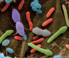 Maladies auto-immunes : le rôle protecteur des bactéries de la flore intestinale 