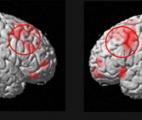 Mieux comprendre les déficits de mémoire des patients schizophrènes et des sujets sains âgés