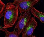 Mieux détecter les cellules-souches malignes