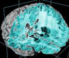 Modéliser l'activité du cerveau en 3D