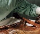 Ötzi était-il cardiaque ?