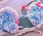 Premier essai au monde d’un virus anti-cancer chez l’homme