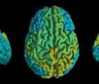 Première carte mondiale des lipides du cerveau humain
