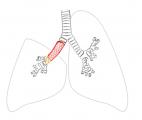 Première mondiale dans la chirurgie du cancer du poumon