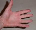 Quand votre main gauche mime ce que fait votre main droite : une histoire de gène