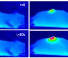 Ramollir les tumeurs par nanohyperthermie