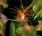 Régénérer le cerveau en produisant de nouveaux neurones