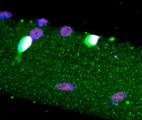 Repérer chaque cellule individuellement, sans recourir à la fluorescence…