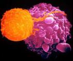Thérapie cellulaire à l'essai contre une forme grave de leucémie 