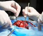 Transplantation cardiaque : une technologie innovante pour conserver plus longtemps le greffon