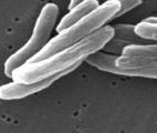 Tuberculose et antibiorésistance : un nouveau prototype de médicament