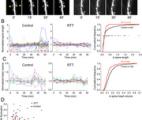 Un espoir de traitement pour le syndrome de Rett