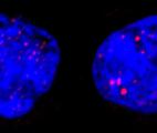 Un mécanisme du vieillissement cellulaire impliqué dans certains cancers