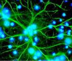 Un médicament pour restaurer la fonction d'auto-nettoyage du cerveau