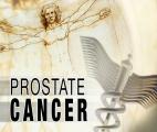 Un nouveau test pour le cancer de la prostate  