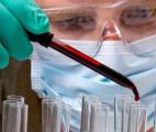 Un nouveau type de test sanguin hypersensible pour détecter certains cancers