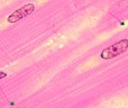 Un tissu cardiaque fonctionnel cultivé en laboratoire