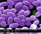 Un vaccin contre l'anthrax disponible aux Etats-Unis