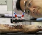 Une bio-imprimante 3D mobile imprime de la peau directement sur des plaies