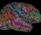 Une carte du cerveau clarifie la répartition des fonctions entre hémisphère gauche et hémisphère droit