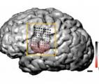 Une expérience qui repousse les limites de la plasticité du cerveau humain 