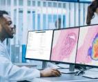 Une IA révolutionnaire pour détecter les cancers de la prostate les plus mortels