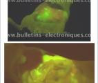 Une nouvelle approche biologique convertit les cellules cancéreuses en cellules normales