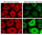 Une nouvelle molécule anticancéreuse très prometteuse !