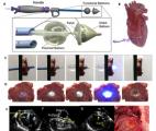 Une technique révolutionnaire pour isoler les ventricules du coeur