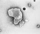 Vers un nouveau vaccin sans injection pour protéger les bébés