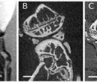 Voir directement l'arthrose grâce à l'imagerie par contraste de phase