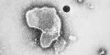 Cancers de l’enfant : un virus génétiquement modifié augmente l’espérance de vie Cancers de l’enfant : un virus génétiquement modifié augmente l’espérance de vie