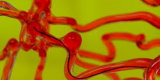 Un robot filiforme capable de se glisser dans les vaisseaux sanguins du cerveau Un robot filiforme capable de se glisser dans les vaisseaux sanguins du cerveau