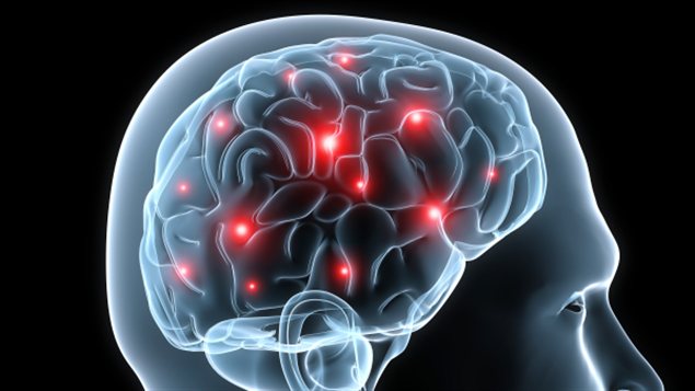 Une Malformation Illustre L Incroyable Plasticite Du Cerveau Rtflash Fr Tregouet Org