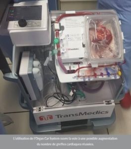 Une Première Médicale Au Chu De Lille Pourrait Augmenter Le - 